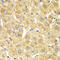 O-Linked N-Acetylglucosamine (GlcNAc) Transferase antibody, 18-577, ProSci, Immunohistochemistry paraffin image 