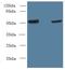 Nitric Oxide Synthase Trafficking antibody, LS-C378122, Lifespan Biosciences, Western Blot image 