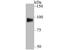 GIT ArfGAP 1 antibody, A02140-2, Boster Biological Technology, Western Blot image 