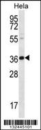 BTG Anti-Proliferation Factor 3 antibody, 56-624, ProSci, Western Blot image 