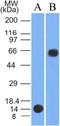 Serine/threonine-protein kinase PINK1, mitochondrial antibody, NBP2-36488, Novus Biologicals, Western Blot image 