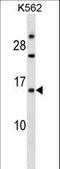 Epithelial Membrane Protein 1 antibody, LS-B12859, Lifespan Biosciences, Western Blot image 