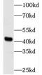 Tubulin Folding Cofactor E Like antibody, FNab08521, FineTest, Western Blot image 