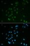 Checkpoint Kinase 2 antibody, orb48327, Biorbyt, Immunofluorescence image 