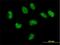 CutC Copper Transporter antibody, H00051076-B01P, Novus Biologicals, Immunofluorescence image 