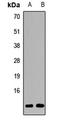 G Protein Subunit Gamma 7 antibody, LS-C668459, Lifespan Biosciences, Western Blot image 