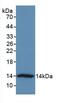 V-Set Domain Containing T Cell Activation Inhibitor 1 antibody, MBS2001319, MyBioSource, Western Blot image 