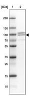 Phosphodiesterase 4D antibody, NBP1-92265, Novus Biologicals, Western Blot image 