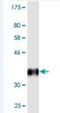 Tribbles Pseudokinase 1 antibody, H00010221-M02, Novus Biologicals, Western Blot image 