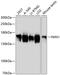 Formin 1 antibody, GTX66171, GeneTex, Western Blot image 