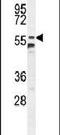 Coiled-Coil Domain Containing 9 antibody, PA5-24274, Invitrogen Antibodies, Western Blot image 