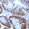 p53 antibody, ADI-905-510-1, Enzo Life Sciences, Immunohistochemistry paraffin image 
