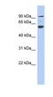 ArfGAP With Coiled-Coil, Ankyrin Repeat And PH Domains 3 antibody, NBP1-70400, Novus Biologicals, Western Blot image 
