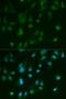 Arrestin Beta 1 antibody, LS-C331197, Lifespan Biosciences, Immunofluorescence image 