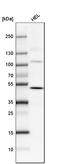 SATB Homeobox 2 antibody, AMAb90635, Atlas Antibodies, Western Blot image 