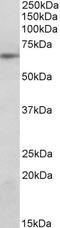 Suppressor Of Cytokine Signaling 5 antibody, STJ70271, St John