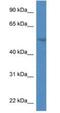 Sphingomyelin Phosphodiesterase Acid Like 3A antibody, NBP1-74114, Novus Biologicals, Western Blot image 