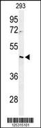 Ribosome Biogenesis Regulator 1 Homolog antibody, 61-646, ProSci, Western Blot image 