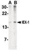 Immediate Early Response 3 antibody, orb87317, Biorbyt, Western Blot image 