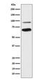 Transcription Factor 4 antibody, M00674, Boster Biological Technology, Western Blot image 