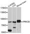 Protein Kinase C Beta antibody, A0495, ABclonal Technology, Western Blot image 
