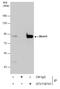 MRE11A antibody, GTX118741, GeneTex, Immunoprecipitation image 