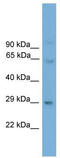Paired Related Homeobox 2 antibody, TA341811, Origene, Western Blot image 