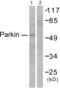Parkin RBR E3 Ubiquitin Protein Ligase antibody, abx013170, Abbexa, Western Blot image 