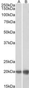 Cytochrome P450 Family 2 Subfamily B Member 6 antibody, 43-694, ProSci, Western Blot image 