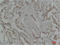 Mitogen-Activated Protein Kinase Kinase 5 antibody, STJ97453, St John