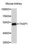 Taspase 1 antibody, STJ26902, St John