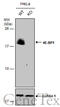 Eukaryotic Translation Initiation Factor 4E Binding Protein 1 antibody, GTX109162, GeneTex, Western Blot image 