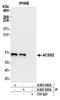 Acyl-CoA Synthetase Short Chain Family Member 2 antibody, A305-292A, Bethyl Labs, Immunoprecipitation image 
