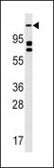 Unc-51 Like Autophagy Activating Kinase 2 antibody, PA5-15381, Invitrogen Antibodies, Western Blot image 