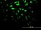 VH3 antibody, H00001847-M03, Novus Biologicals, Immunocytochemistry image 