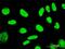 TSPY Like 1 antibody, H00007259-M01, Novus Biologicals, Immunofluorescence image 