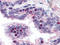 NIMA Related Kinase 2 antibody, AP07250PU-N, Origene, Immunohistochemistry paraffin image 