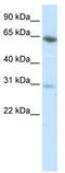 Zinc Finger Protein 195 antibody, TA343663, Origene, Western Blot image 