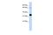 Troponin I1, Slow Skeletal Type antibody, PA5-42109, Invitrogen Antibodies, Western Blot image 