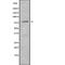 Polyribonucleotide Nucleotidyltransferase 1 antibody, abx217840, Abbexa, Western Blot image 