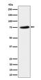 Protein Phosphatase, Mg2+/Mn2+ Dependent 1G antibody, M06725-1, Boster Biological Technology, Western Blot image 