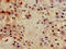 Integrin Subunit Beta 4 antibody, CSB-PA011887LA01HU, Cusabio, Immunohistochemistry frozen image 
