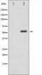 Checkpoint Kinase 2 antibody, TA325374, Origene, Western Blot image 