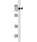 Bruton Tyrosine Kinase antibody, F53652-0.1ML, NSJ Bioreagents, Western Blot image 