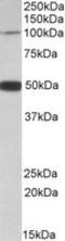 Patched Domain Containing 1 antibody, LS-C139673, Lifespan Biosciences, Western Blot image 