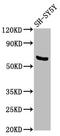 Pyruvate Dehyrogenase Phosphatase Catalytic Subunit 1 antibody, CSB-PA878946LA01HU, Cusabio, Western Blot image 