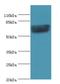 G Protein-Coupled Receptor Kinase 4 antibody, LS-C369728, Lifespan Biosciences, Western Blot image 