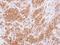 Regulator Of G Protein Signaling 10 antibody, LS-C186385, Lifespan Biosciences, Immunohistochemistry paraffin image 