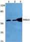 T-Box 22 antibody, A06861-1, Boster Biological Technology, Western Blot image 