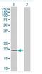 Myosin Light Chain 7 antibody, ab68086, Abcam, Western Blot image 